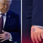 El misterio detrás del golpe cerebral del líder estadounidense: ¿qué revelan las primeras informaciones sobre la salud del presidente Trump?